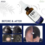 FEG PLUS Hair Growth Spray